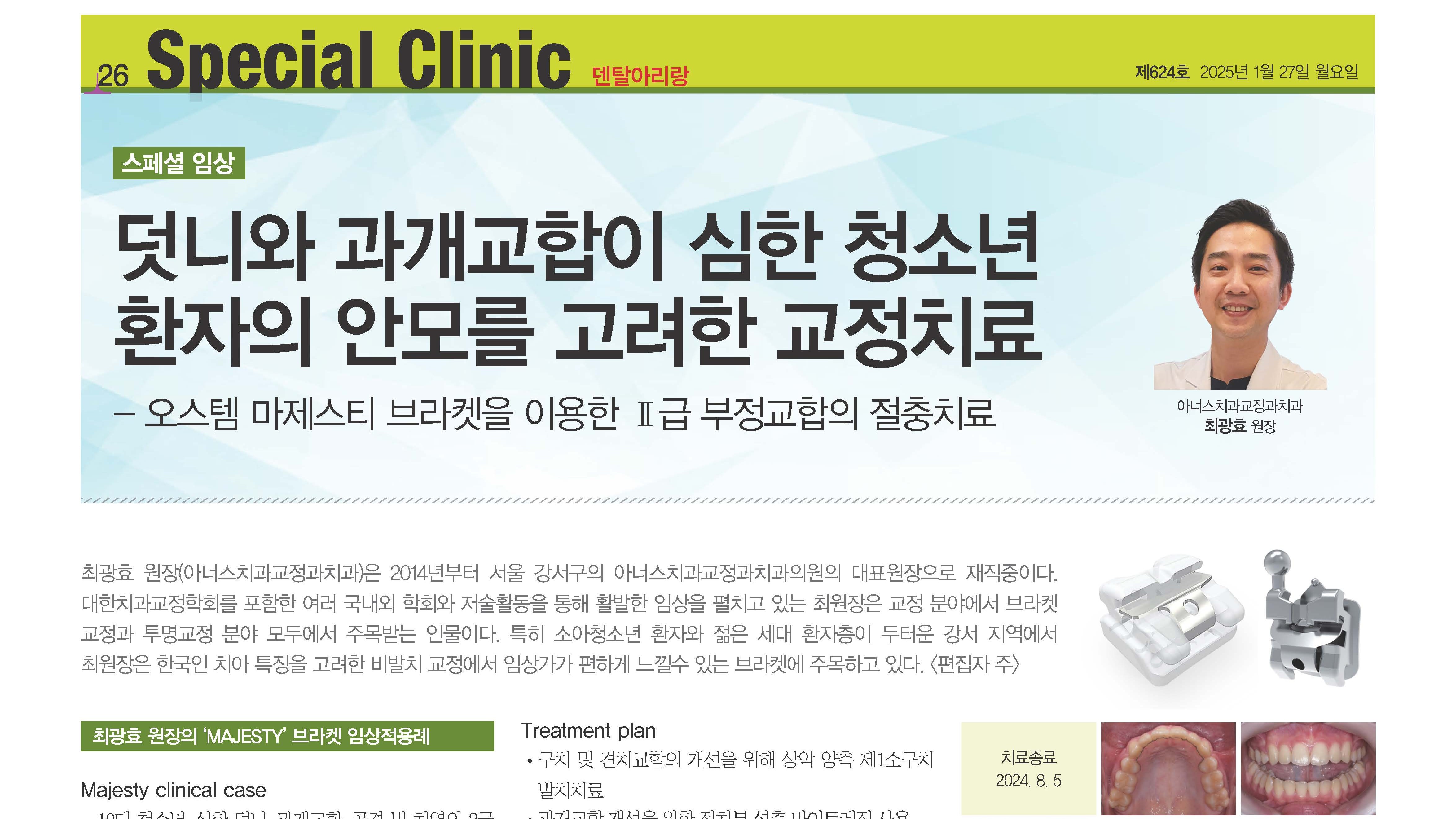 마제스티 임상 케이스 1. 과개교합 환자의 상악소구치 발치교정